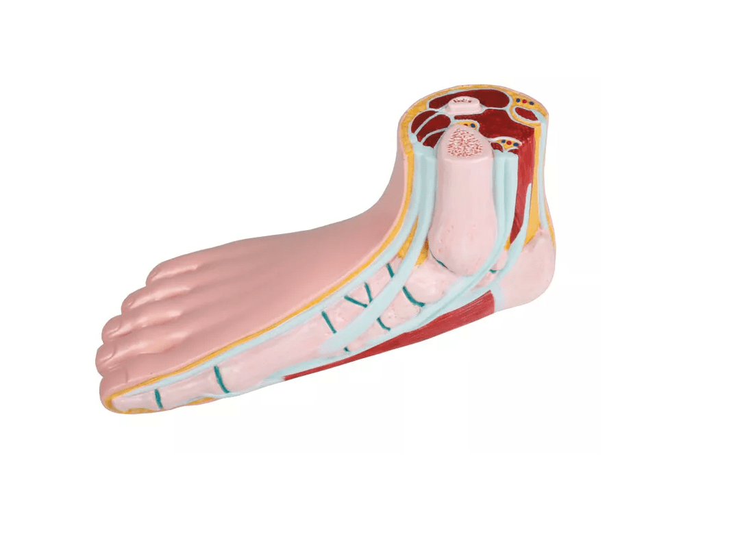 Plattfuß, pes planus - Erler - Zimmer